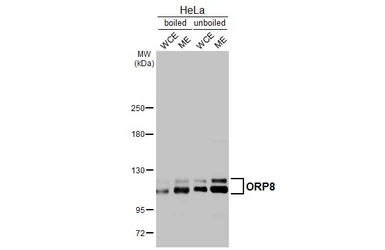 Anti-ORP8 antibody used in Western Blot (WB). GTX121273