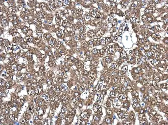 Anti-PDIA6 antibody [N1N3] used in IHC (Paraffin sections) (IHC-P). GTX121275