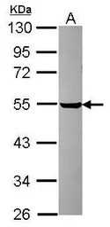 Anti-PDIA6 antibody [N1N3] used in Western Blot (WB). GTX121275