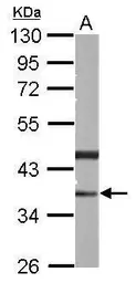 Anti-PHYHIP antibody used in Western Blot (WB). GTX121276