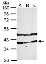 Anti-PHYHIP antibody used in Western Blot (WB). GTX121276