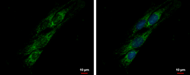 Anti-PITRM1 antibody used in Immunocytochemistry/ Immunofluorescence (ICC/IF). GTX121279
