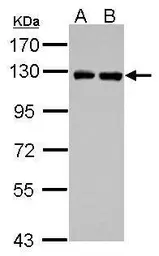 Anti-PITRM1 antibody used in Western Blot (WB). GTX121279