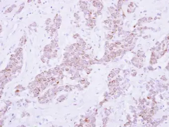 Anti-PSD4 antibody [C1C2], Internal used in IHC (Paraffin sections) (IHC-P). GTX121282