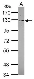 Anti-PSD4 antibody [C1C2], Internal used in Western Blot (WB). GTX121282