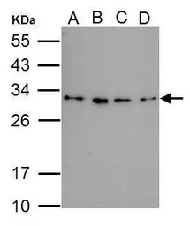 Anti-RWDD3 antibody used in Western Blot (WB). GTX121303