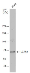 Anti-LZTR2 antibody [N1N2], N-term used in Western Blot (WB). GTX121305