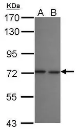 Anti-LZTR2 antibody [N1N2], N-term used in Western Blot (WB). GTX121305