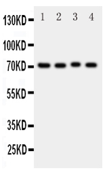 Anti-ABCG2 antibody used in Western Blot (WB). GTX12131