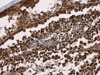 Anti-SMG7 antibody used in IHC (Paraffin sections) (IHC-P). GTX121320