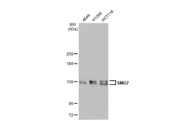 Anti-SMG7 antibody used in Western Blot (WB). GTX121320