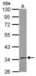 Anti-TRUB2 antibody [N1C3] used in Western Blot (WB). GTX121339