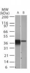 Anti-IKB alpha antibody [6A920] used in Western Blot (WB). GTX12134