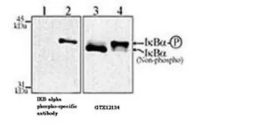 Anti-IKB alpha antibody [6A920] used in Western Blot (WB). GTX12134