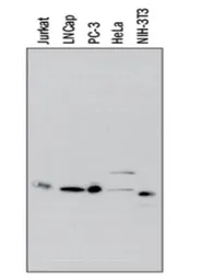 Anti-IKB alpha antibody [6A920] used in Western Blot (WB). GTX12134