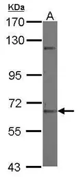 Anti-ZNF334 antibody [N1C1] used in Western Blot (WB). GTX121366