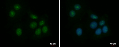 Anti-ZNF417 antibody [C1C3] used in Immunocytochemistry/ Immunofluorescence (ICC/IF). GTX121370