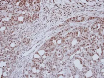 Anti-ZNF417 antibody [C1C3] used in IHC (Paraffin sections) (IHC-P). GTX121370