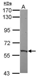 Anti-ZNF417 antibody [C1C3] used in Western Blot (WB). GTX121370