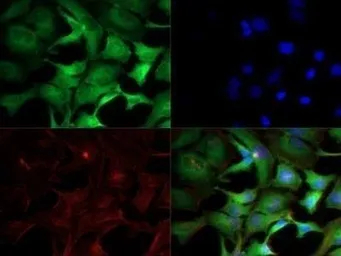 Anti-IKK alpha antibody [14A231] used in Immunocytochemistry/ Immunofluorescence (ICC/IF). GTX12138