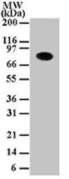 Anti-IKK alpha antibody [14A231] used in Western Blot (WB). GTX12138