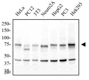Anti-IKK alpha antibody [14A231] used in Western Blot (WB). GTX12138
