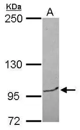 Anti-BRPF3 antibody [N1N2], N-term used in Western Blot (WB). GTX121388