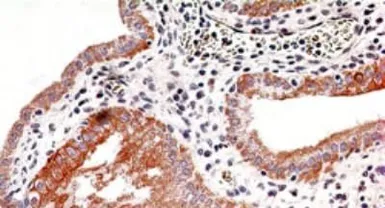 Anti-IKK beta antibody [10AG2] used in IHC (Paraffin sections) (IHC-P). GTX12139