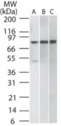 Anti-IKK beta antibody [10AG2] used in Western Blot (WB). GTX12139