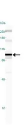 Anti-IKK beta antibody [10AG2] used in Western Blot (WB). GTX12139