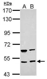 Anti-BRUNOL4 antibody used in Western Blot (WB). GTX121390