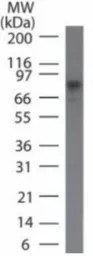 Anti-IKK beta antibody [10A9B6] used in Western Blot (WB). GTX12140