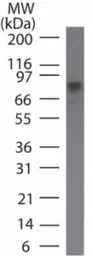Anti-IKK beta antibody [10A9B6] used in Western Blot (WB). GTX12140