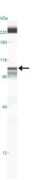 Anti-IKK beta antibody [10A9B6] used in Western Blot (WB). GTX12140