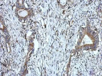 Anti-DUS2L antibody used in IHC (Paraffin sections) (IHC-P). GTX121407