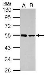 Anti-DUS2L antibody used in Western Blot (WB). GTX121407