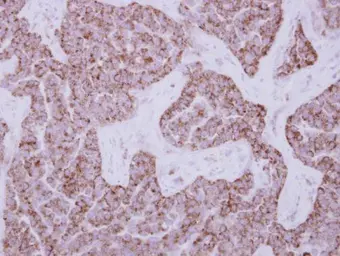 Anti-DUS2L antibody used in IHC (Paraffin sections) (IHC-P). GTX121408