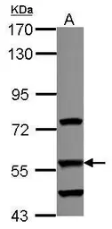 Anti-DUS2L antibody used in Western Blot (WB). GTX121408