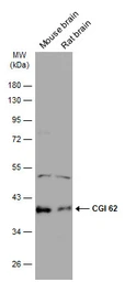 Anti-CGI 62 antibody used in Western Blot (WB). GTX121412