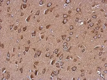 Anti-WDR16 antibody used in IHC (Paraffin sections) (IHC-P). GTX121444