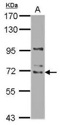 Anti-WDR16 antibody used in Western Blot (WB). GTX121444