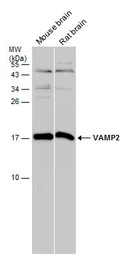 Anti-VAMP2 antibody used in Western Blot (WB). GTX121462