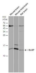 Anti-FABP7 antibody [N1C3] used in Western Blot (WB). GTX121467