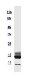 Human RBP5 protein, His tag. GTX121469-pro