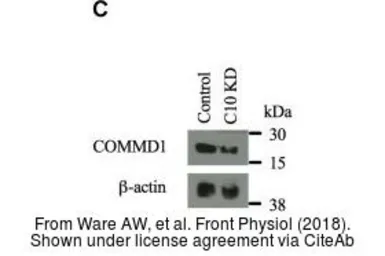 Anti-COMMD10 antibody used in Western Blot (WB). GTX121488