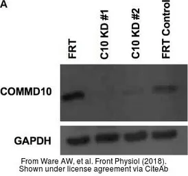 Anti-COMMD10 antibody used in Western Blot (WB). GTX121488