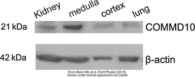 Anti-COMMD10 antibody used in Western Blot (WB). GTX121488
