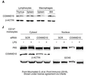 Anti-COMMD10 antibody used in Western Blot (WB). GTX121488