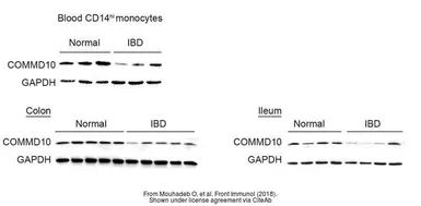 Anti-COMMD10 antibody used in Western Blot (WB). GTX121488
