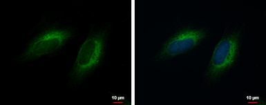 Anti-COMMD10 antibody used in Immunocytochemistry/ Immunofluorescence (ICC/IF). GTX121488